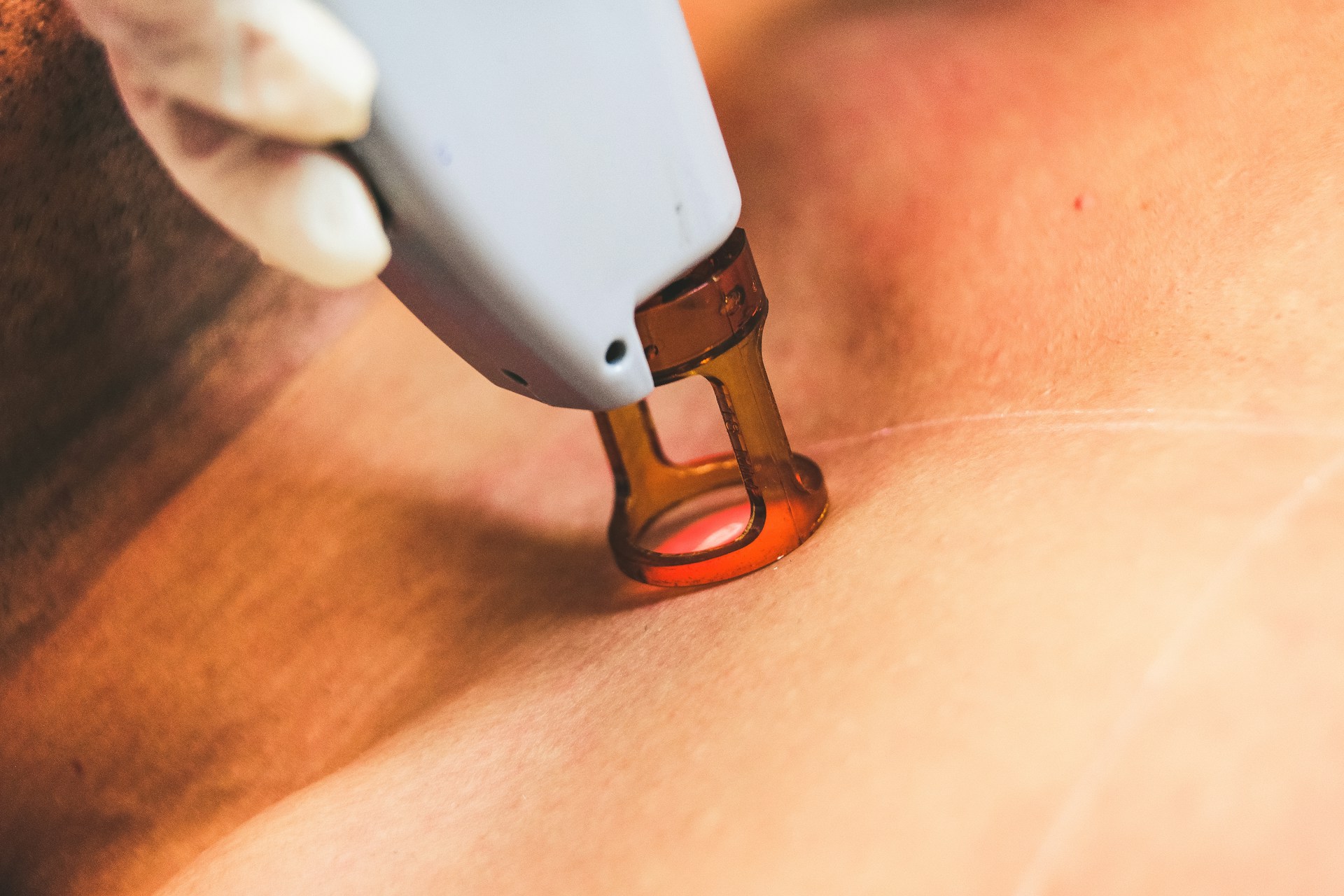 Laser Therapy